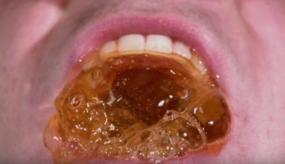 Coca Cola, gli effetti sui denti in un video